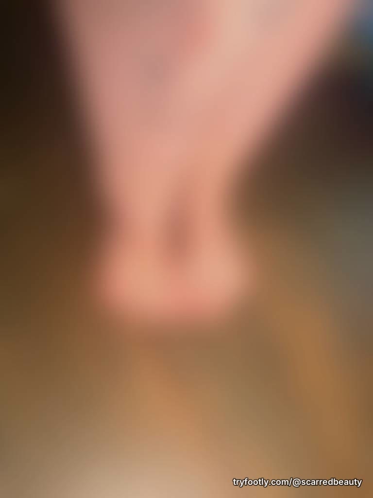 Toe gaps are both beautiful and healthy ✨