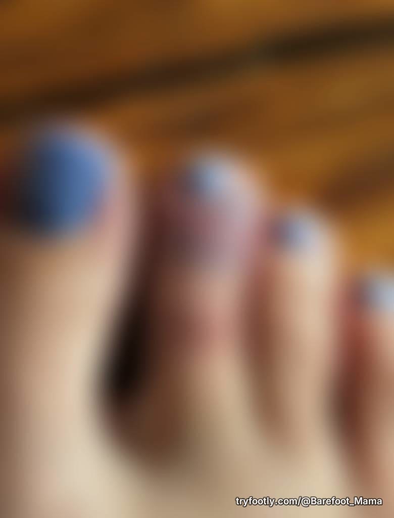 Slipped on a wet rock at the lake and bruised my poor toe quite badly.