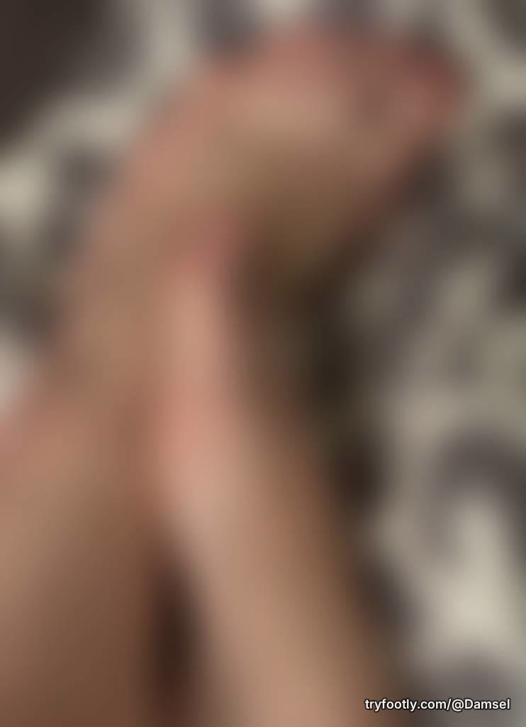 Poor toes want love and attention after so long mistreated….