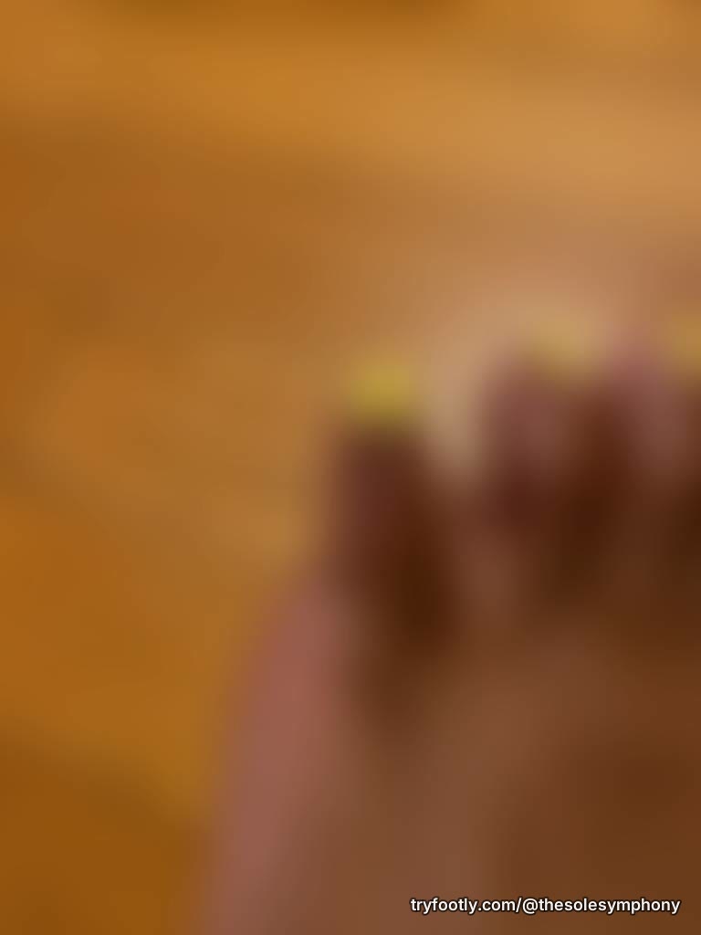 A little bruised and very tender...How are you going to take care of them? What song fits 