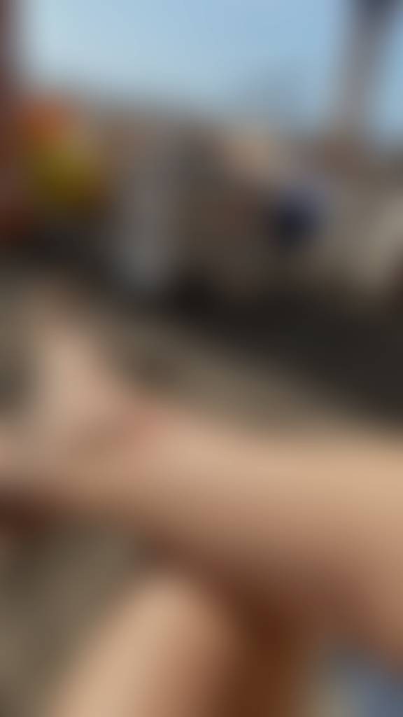 DM me I’m begging you🥵 Got myself a little scar at the beach Wants some videos ?