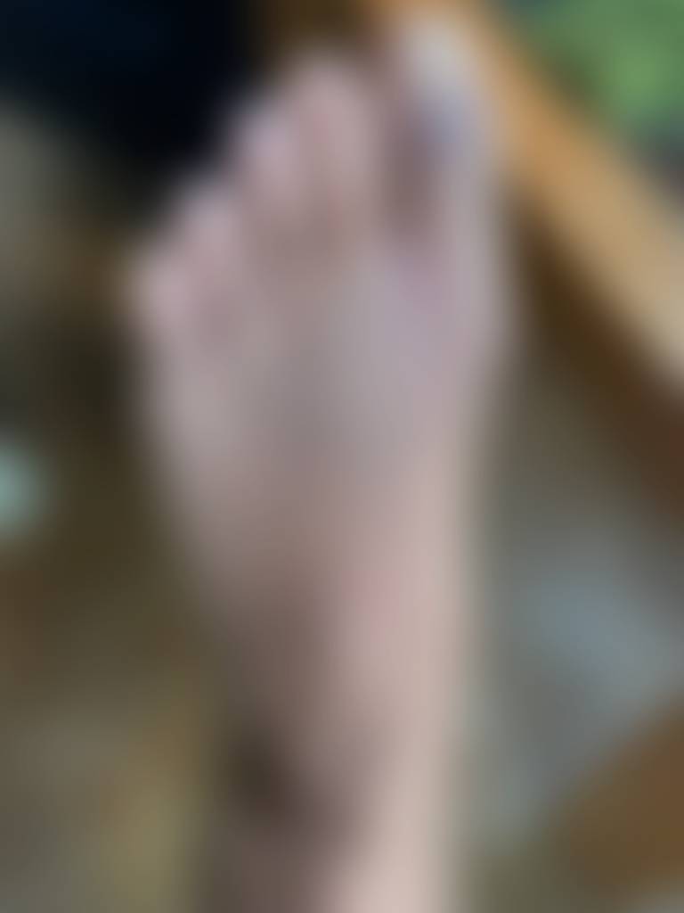 The day after I broke my toe. I’ve been so lucky the fracture is in a spot that means I ca