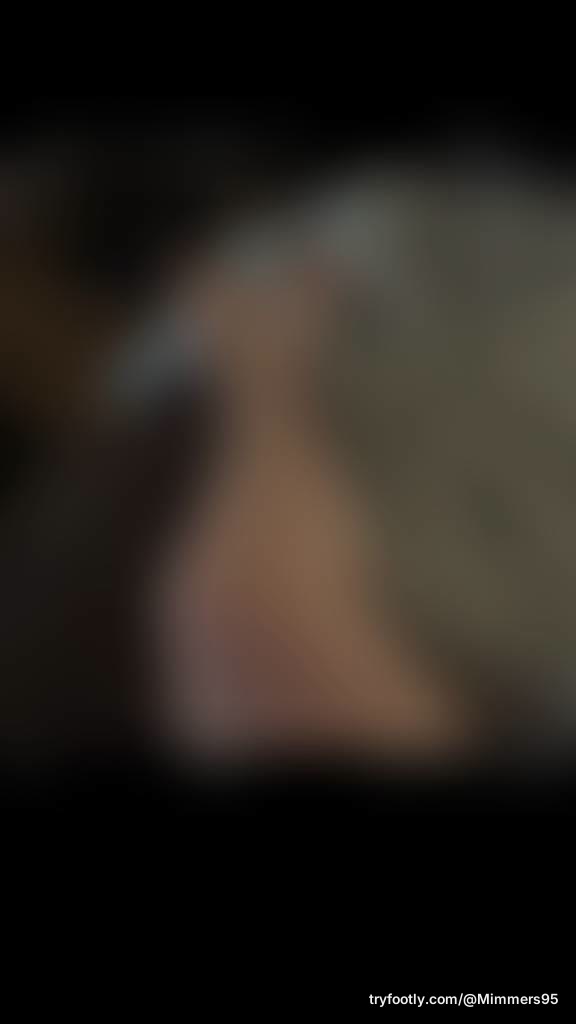 If toes are white.. hands should be??