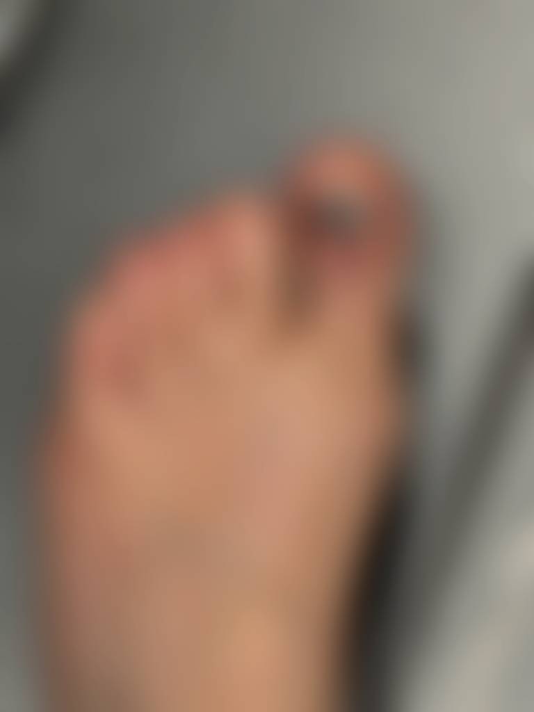 When you drop a bread board on your left big toe…Ooowwcchhh😞