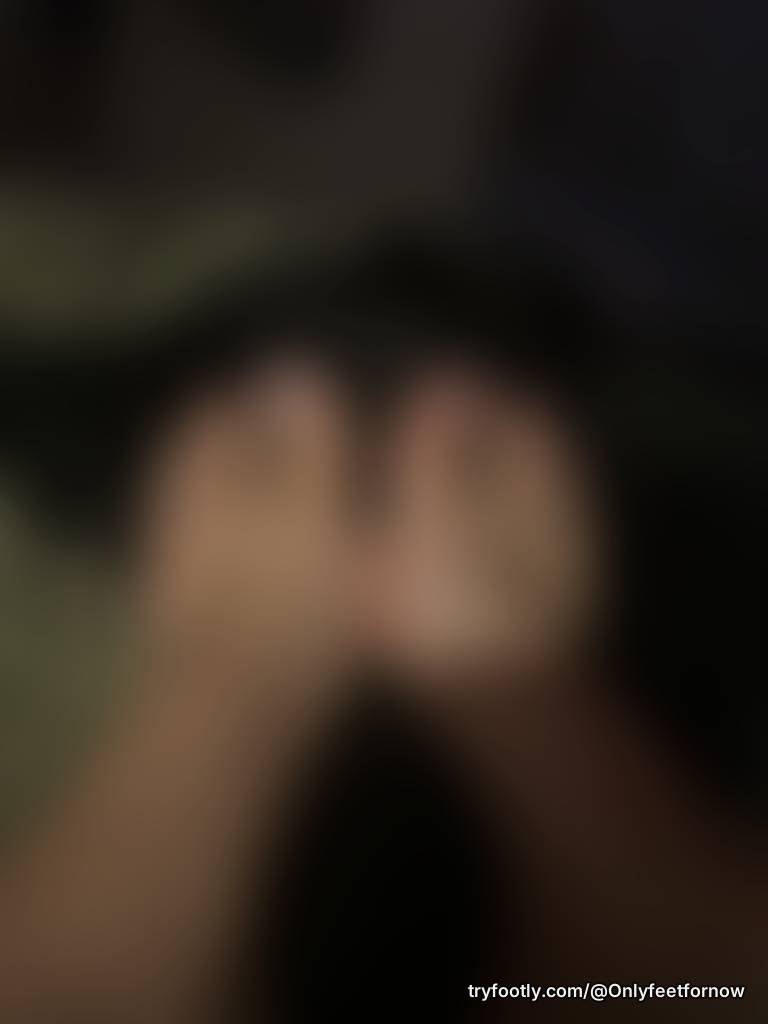 High heels at my friends wedding left me with bruised feet this week 🥺