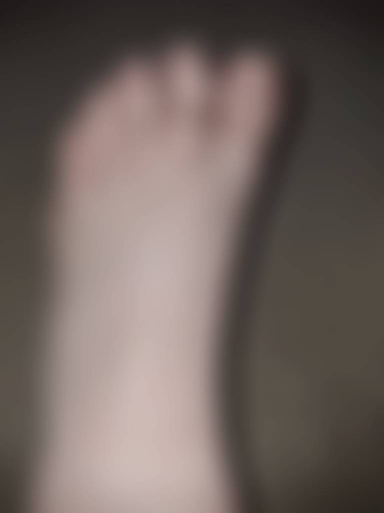 Toe rings