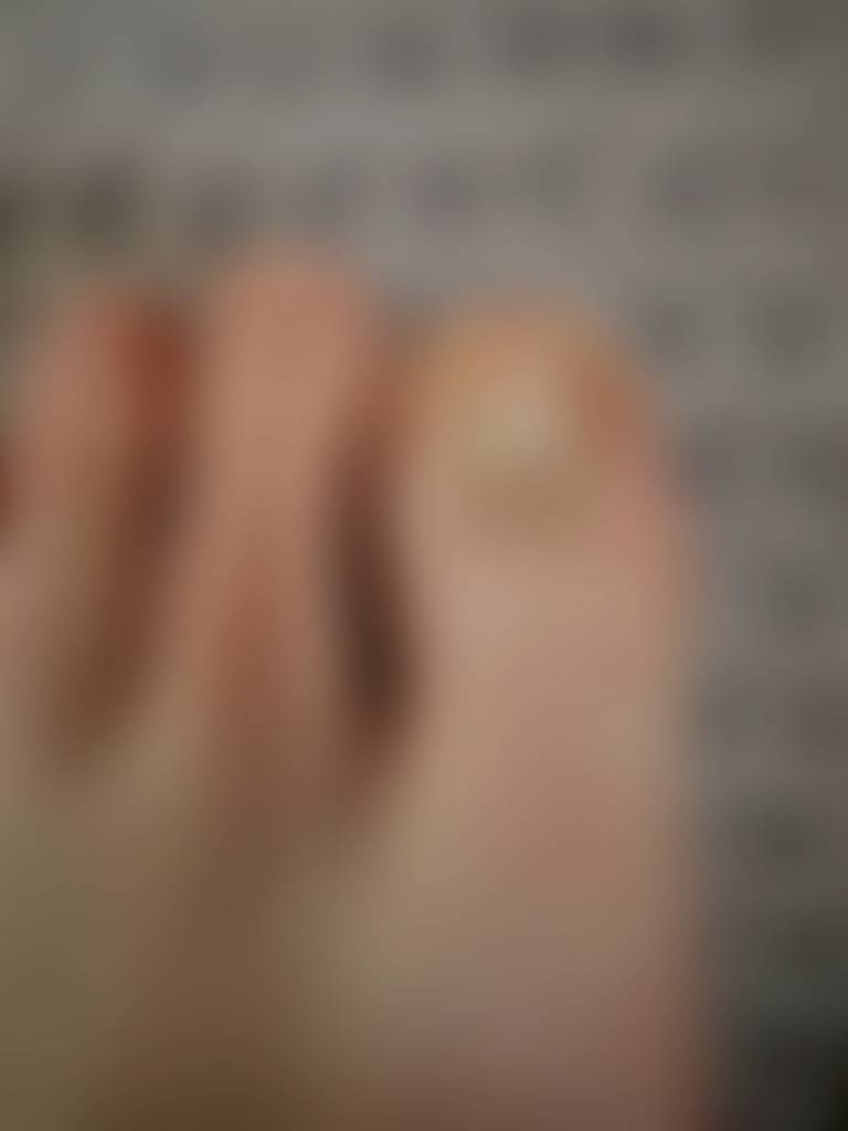 See an unhappy toe up close!