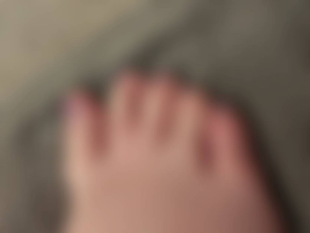 Toes x