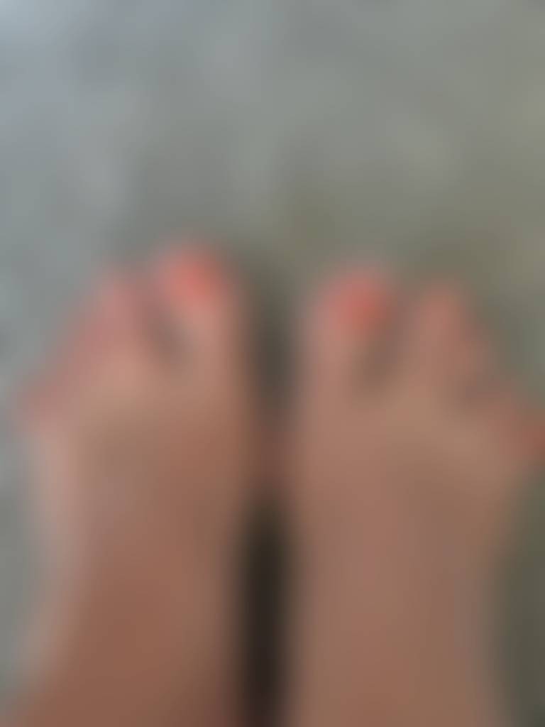Toe spread and toe pads