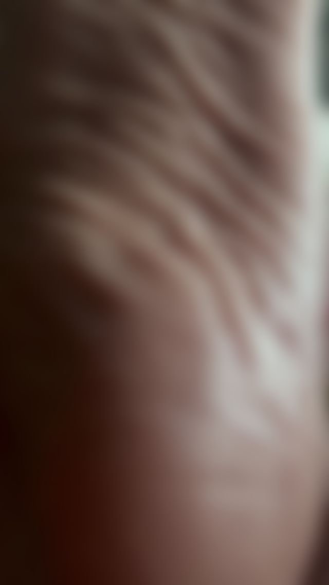 Wrinkles