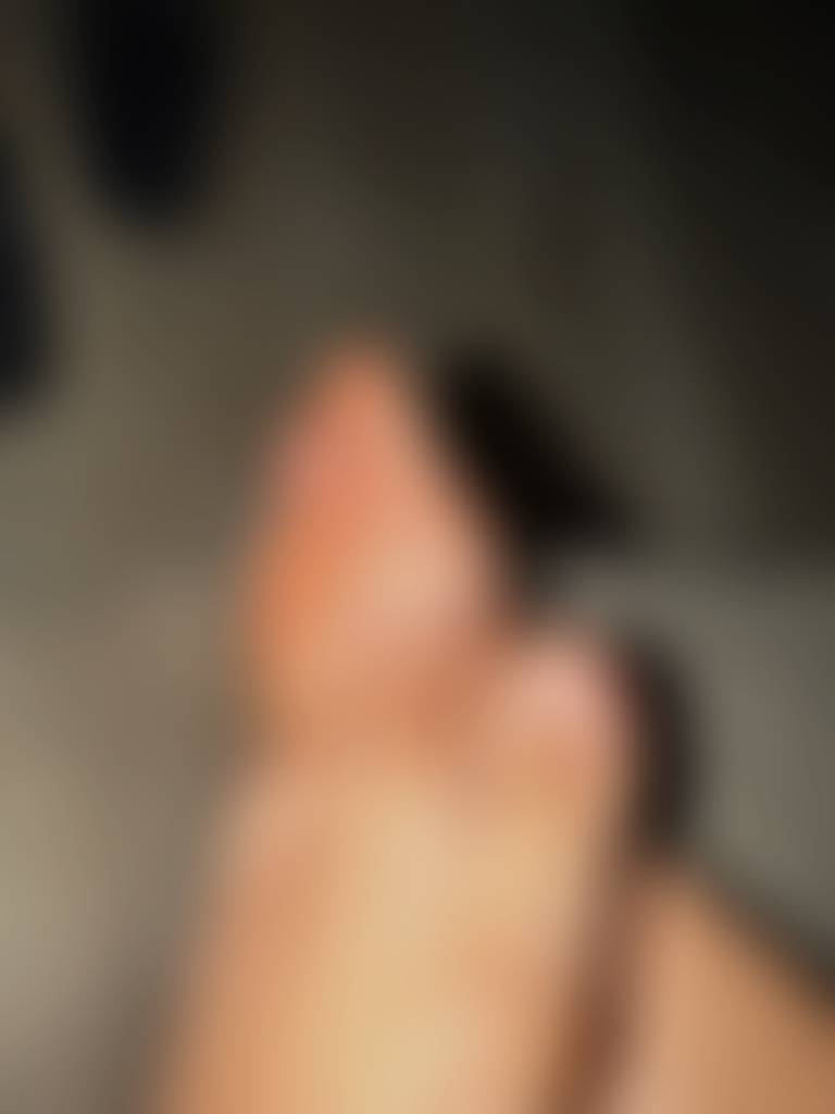 My feet when they aren’t done😫