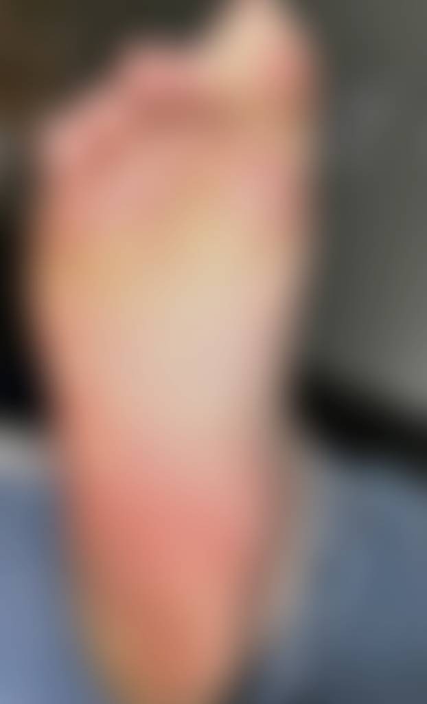 Close up