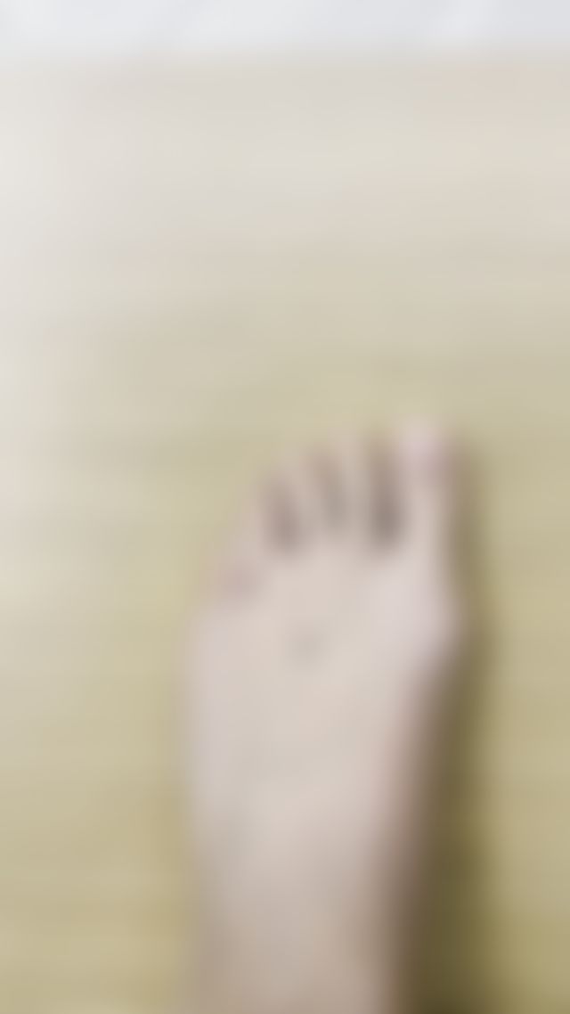 Not pretty… just proof I play hard 🏀 Bruised toes, rough soles, and basketball feet after 