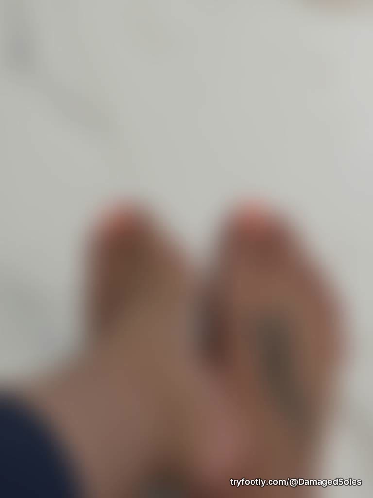 These toes are getting some need polish in two days…any ideas on what color to do??