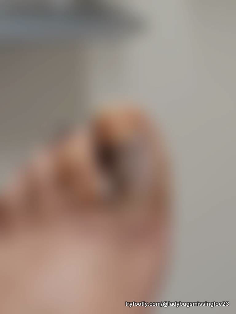 The beginning on how I lost my toe