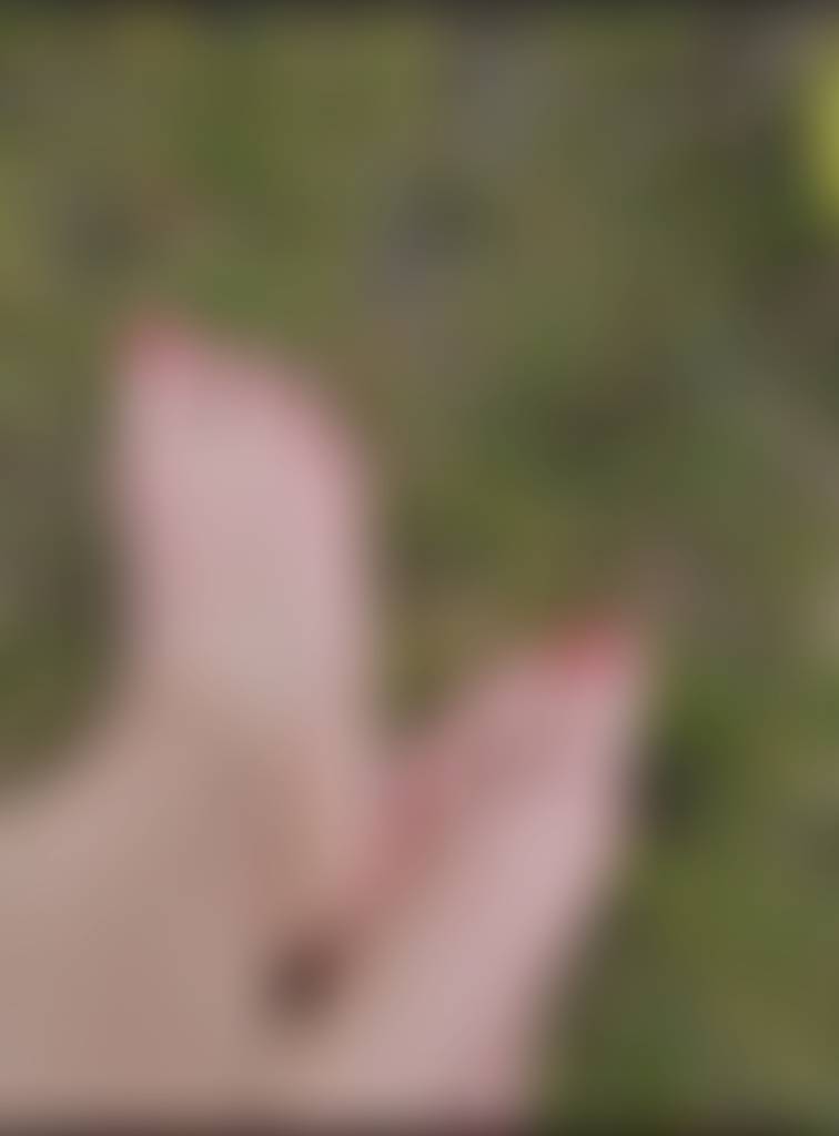 Very flat feet
