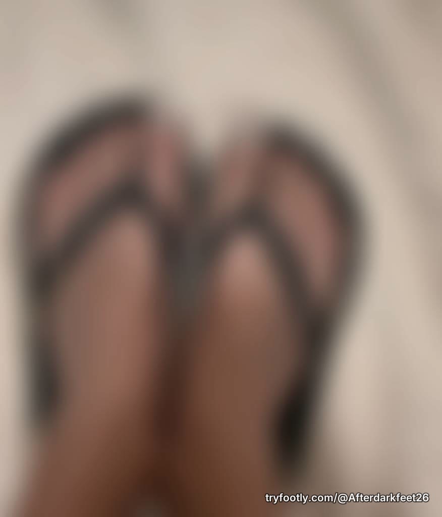 Ugly feet, cute sandals 🩴