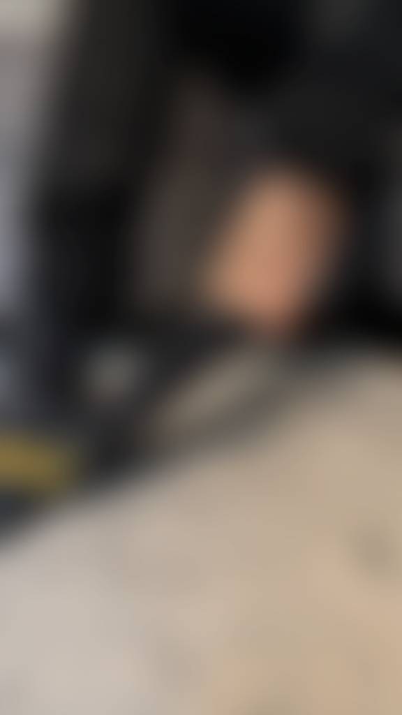 Definitely way worse up close👀😈 7 pics | full removal| close-ups