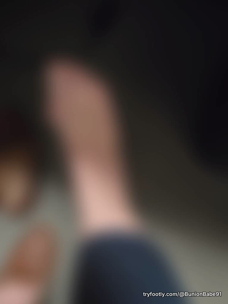 Do you like bunions?